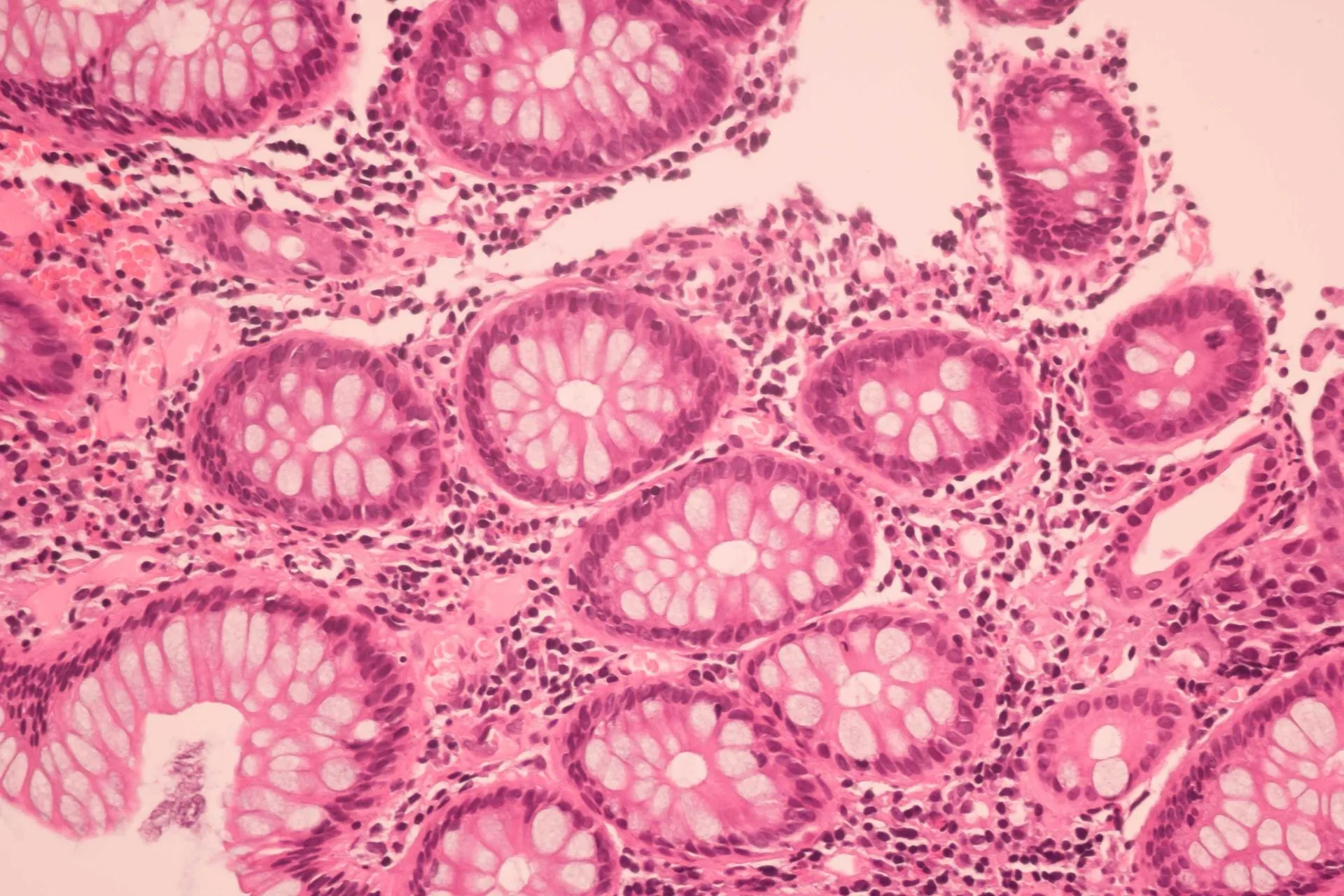 Cancer cells vs normal cells