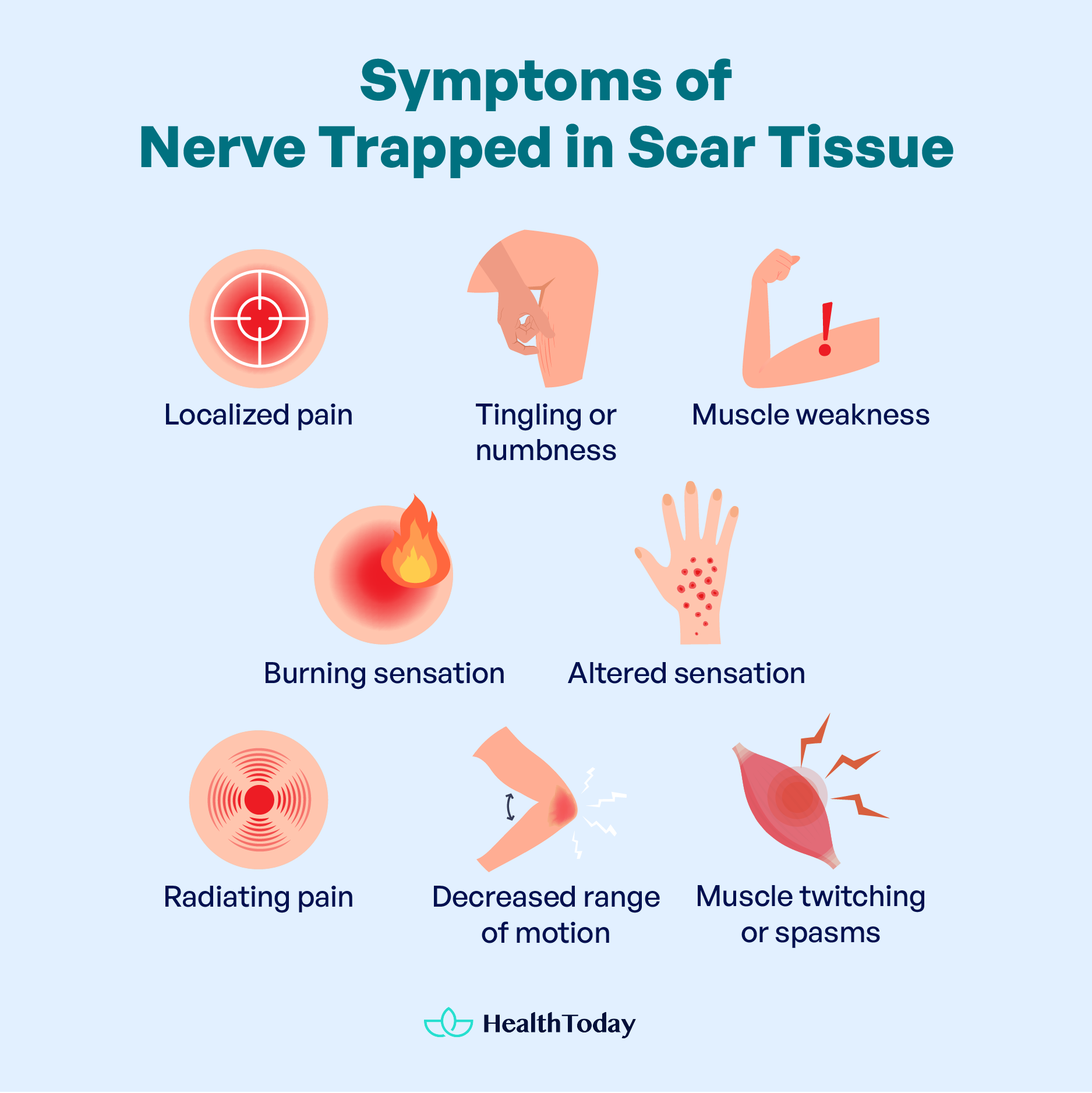 Nerve Trapped in Scar Tissue Causes Treatment and Care 03