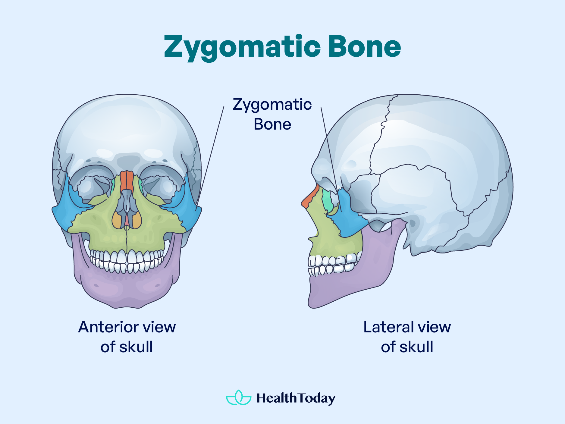 Zygomatic Bone Pain Causes and Home Remedies 29