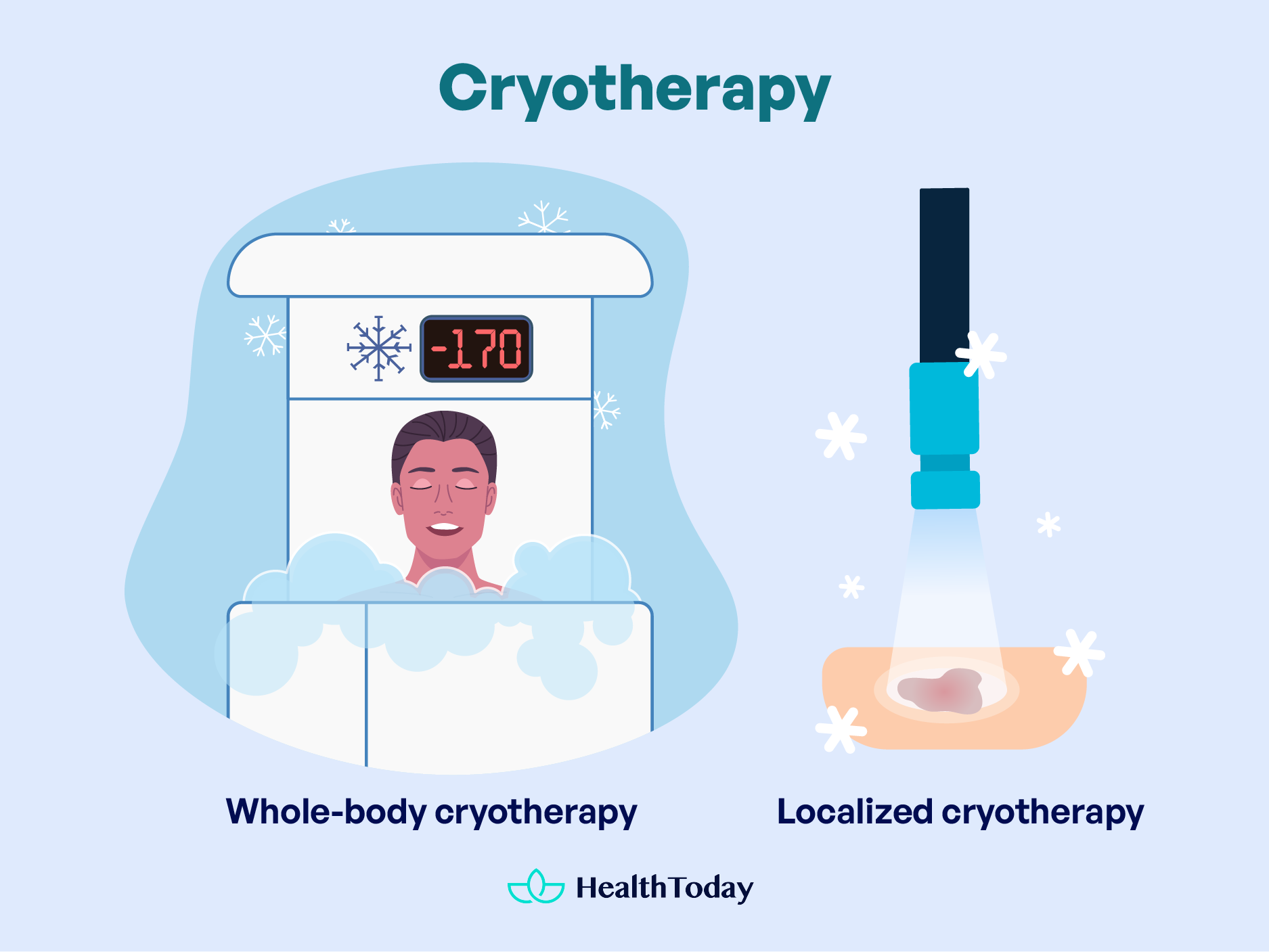 How Often Can You Do Cryotherapy Weight Loss and Beyond 01
