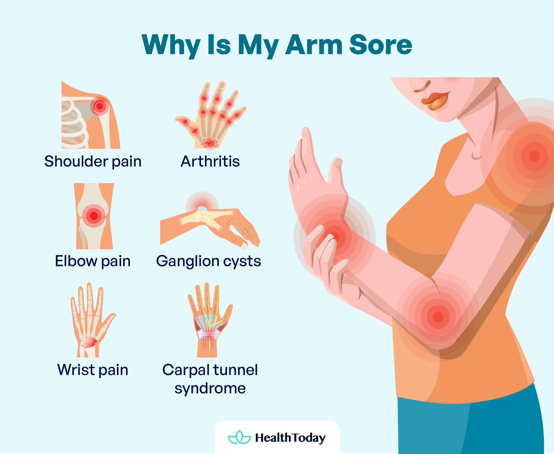 Why Is My Arm Sore Causes Symptoms and Treatment 01