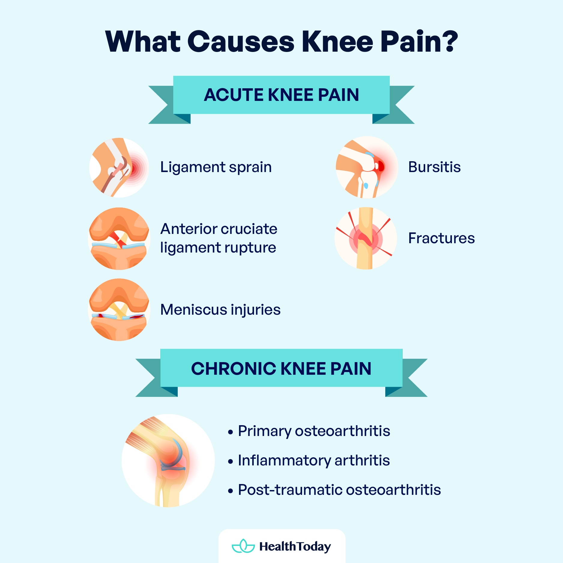 How to Make My Knee Stop Hurting Causes and When to Worry 01